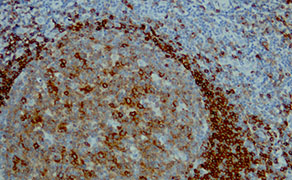 CD79b