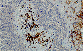CD82