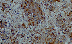 Cdk4