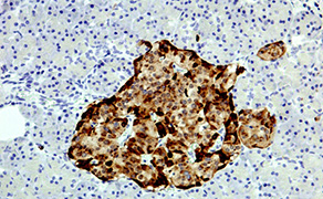 Chromogranin A