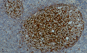 Clusterin/Apolipoprotein J