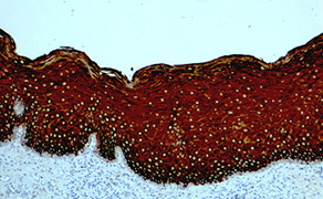 Cytokeratin 13
