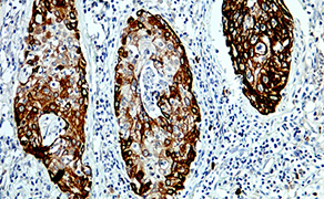 Cytokeratin 14