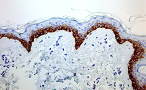 Cytokeratin 15
