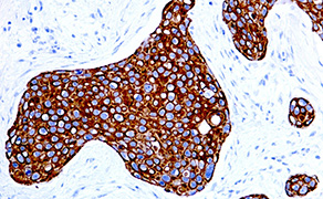 Cytokeratin 17