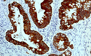Cytokeratin 18