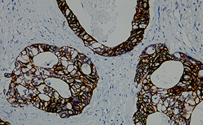 Cytokeratin 19