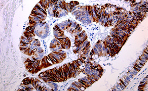 Cytokeratin 20