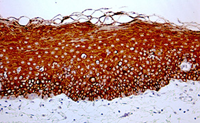 Cytokeratin 4