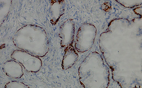 Cytokeratin 5