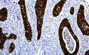 Cytokeratin 6