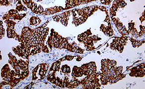 Cytokeratin 7