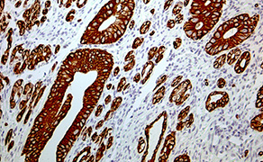 Cytokeratin 8