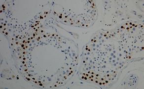 DMRT1