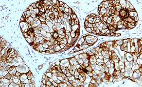 EGFR Phospho (pY1068)