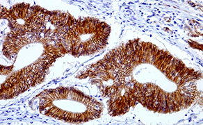 Beta-Catenin