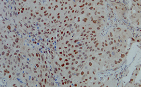 ERCC1