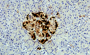 Glucagon