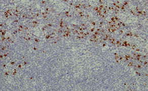Granzyme B