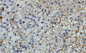 HER2 / ErbB2 Phospho (pY877)
