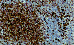 HLA-DRB1