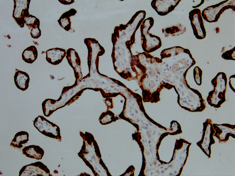 Human Placental Lactogen (HPL)