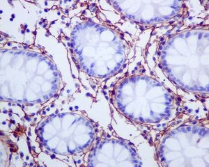 GeneTex Collagen I antibody [EPR7785]