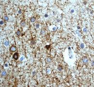 GeneTex NF-H antibody [EP673Y]