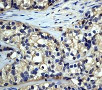 GeneTex DARPP-32 antibody [EP720Y]