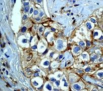 GeneTex EGFR (phospho Tyr1092) antibody [EP774Y]