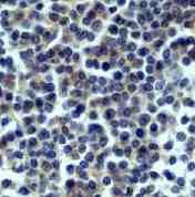 GeneTex CD32B antibody [EP888Y]