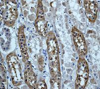 GeneTex Serum amyloid P-component antibody [EP1018Y]