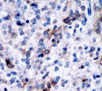 GeneTex NGF Receptor antibody [EP1039Y]
