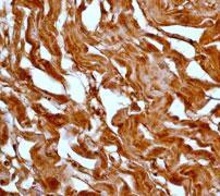GeneTex MKK6 antibody [EP558Y], C-term