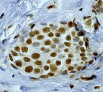 GeneTex hnRNP K antibody [EP943Y], N-term
