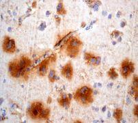 GeneTex NGF beta antibody [EP1320Y], C-term