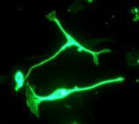GeneTex NVEGF antibody [EP1176Y], C-term
