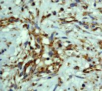 GeneTex NVEGF antibody [EP1176Y], C-term