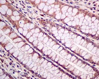 GeneTex PTEN antibody [EPR9941]