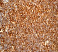 GeneTex HLA-A antibody [EP1395Y]