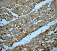 GeneTex RAIDD antibody [EPR1640Y], C-term