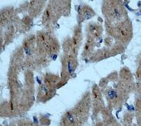 GeneTex ILK antibody [EP1593Y]