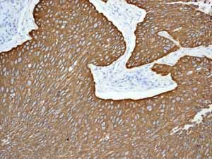 GeneTex Cytokeratin 5 antibody [EP1601Y]