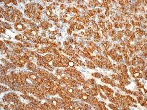 GeneTex CD44 antibody [EPR1013Y]