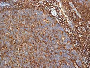 GeneTex CD44 antibody [EPR1013Y]