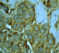 GeneTex MMP14 antibody [EP1264Y]