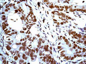 GeneTex HIF1 alpha antibody [EP1215Y], C-term