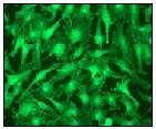 GeneTex pan-Cadherin antibody [EPR1792Y]