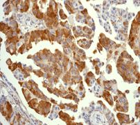 GeneTex RPS6 (phospho Ser235) antibody [EP1338(2)Y]
