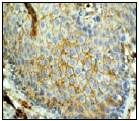 GeneTex pan-Cadherin antibody [EPR1792Y]